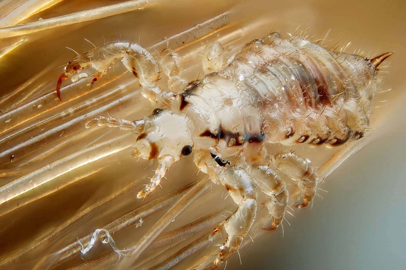 Galvos utėlė (Pediculus humanus capitis) ant plaukų